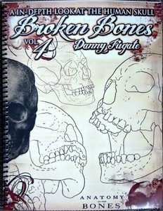 Danny Fugate - Broken Bones
